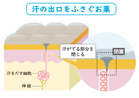 汗の出口をふさぐお薬