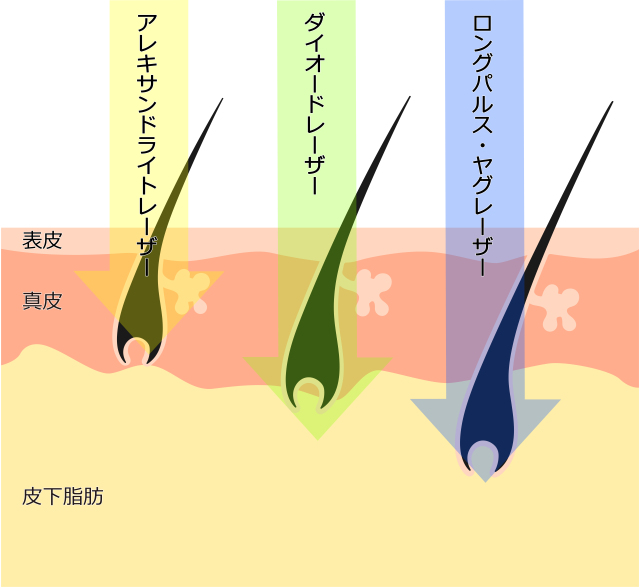 2つの波長を1台に搭載