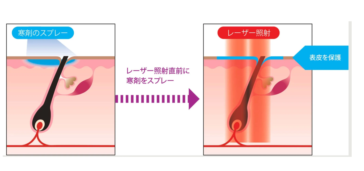 独自の表皮冷却システム